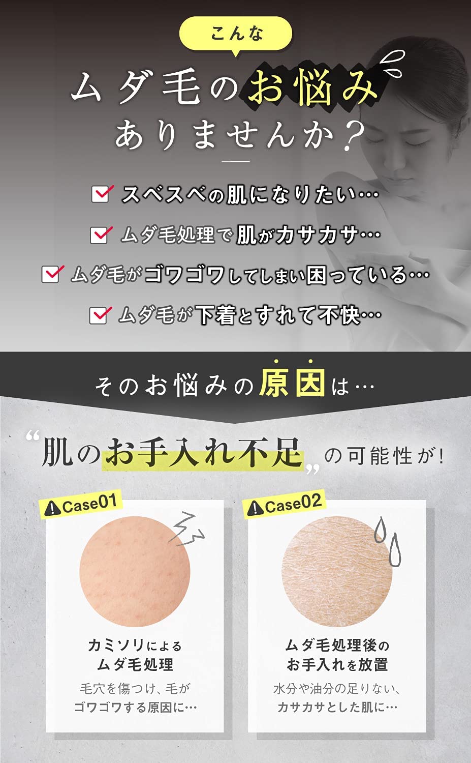 デリケートゾーン 保湿 ENAVIS 400g エナビス vio 保湿クリーム シェーバー 除毛後